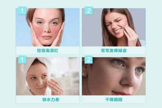 敏感肌怎樣修復(fù)成正常肌膚