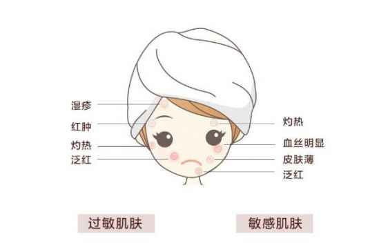 敏感肌怎樣修復(fù)成正常肌膚